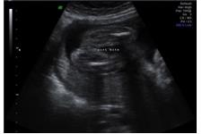 Baby to Be - 4d Ultrasound image 3