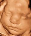 3D Ultrasound  Sono Image image 4