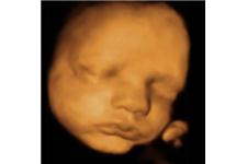 Baby in Sight 3D/4D Fetal Ultrasound image 3
