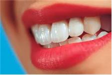 Dental-X Smile Centres image 3