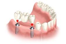 Erbsville Dental Clinic image 3