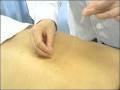 AAA Acupuncture image 4