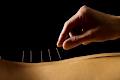 Acupuncture And TCM-Peterborough-L. Bissonnette image 1