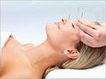 Acupuncture-Ottawa image 6