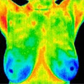 Breast Health Thermography Clinic of Halton Hills and Oakville image 2