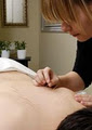 Continuum Wellness - Toronto Massage Therapy Clinic image 6