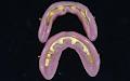 Hillhurst Denture Clinic image 3