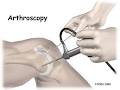 Honsberger Physiotherapy image 4