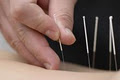 Lee-Ann Cudmore Acupuncture & Traditional Chinese Medicine image 5