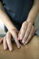 Lee-Ann Cudmore Acupuncture & Traditional Chinese Medicine image 6