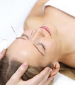 Murrayville Acupuncture image 2