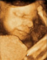Peek A Boo Clinic: Diagnostic 3D Ultrasound and 4D Ultrasound in Montreal image 2