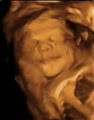 Peek A Boo Clinic: Diagnostic 3D Ultrasound and 4D Ultrasound in Montreal image 3