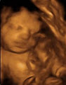 Peek A Boo Clinic: Diagnostic 3D Ultrasound and 4D Ultrasound in Montreal image 5