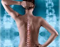 Spinal Decompression - Vancouver Chiropractor - Vancouver Chiropractic image 5