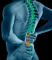 Spinal Decompression - Vancouver Chiropractor - Vancouver Chiropractic image 6