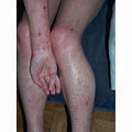 Vancouver Allergy | Clear Allergy and Wellness image 4