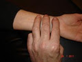 Wilson Acupuncture image 4
