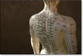Woodstock Chinese Med & Acupuncture image 5