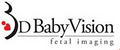 3D Babyvision Fetal Imaging image 3