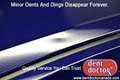 Dent Doctor Paintless Dent Repair logo
