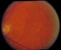 Edmonton Vision Centre - Eye Exams, Eye Doctors & Best Optical Store image 3