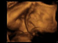 PEEK-A-BOO BABY image 1