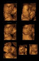 Peek-a-Boo Baby 3D Ultrasound Ltd. RED DEER image 2