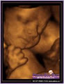 Peek-a-Boo Baby 3D Ultrasound Ltd. RED DEER logo