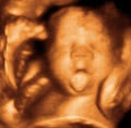 Precious Peeks - 3D/4D Baby Ultrasound Windsor Ontario image 2