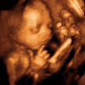 Precious Peeks - 3D/4D Baby Ultrasound Windsor Ontario image 3