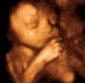 Precious Peeks - 3D/4D Baby Ultrasound Windsor Ontario image 4