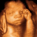 Precious Peeks - 3D/4D Baby Ultrasound Windsor Ontario image 5