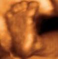 Precious Peeks - 3D/4D Baby Ultrasound Windsor Ontario image 6