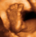 Precious Peeks - 3D/4D Baby Ultrasound Windsor Ontario logo
