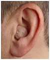 The Hearing Loss Clinic image 2
