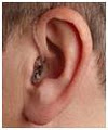 The Hearing Loss Clinic image 2