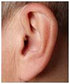 The Hearing Loss Clinic image 3