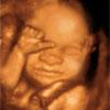 UC BABY Prenatal 3D Ultrasound image 2