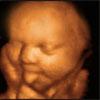 UC BABY Prenatal 3D Ultrasound image 4