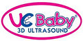 UC BABY Prenatal 3D Ultrasound image 5