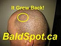 Bald Spot logo