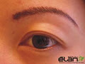 Elan Beauty Clinic image 2