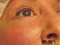 Elan Beauty Clinic image 3