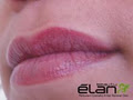Elan Beauty Clinic image 5