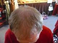 Look 140 Hairjuvenation image 6