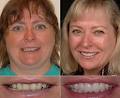 Roper Aesthetic Dentistry image 4