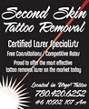 Second Skin Tattoo Removal logo