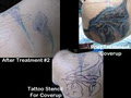 The Arthouse Tattoo and Laser Removal Studio image 3
