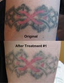 The Arthouse Tattoo and Laser Removal Studio image 5